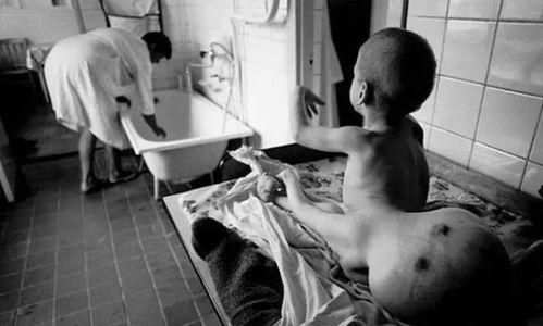 日本福岛变异人,核灾难下的生存与挑战